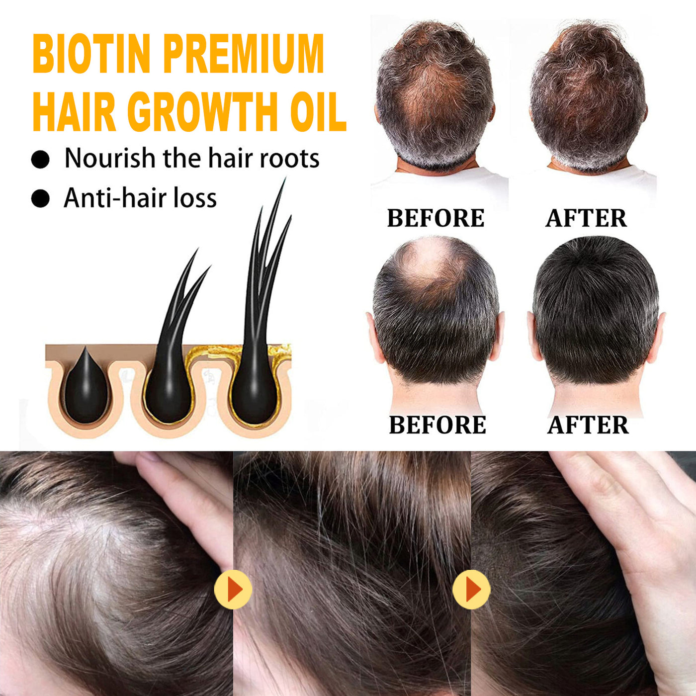 Biotin Hair Oil Treatment – for Thick, Smooth, & Healthy Hair